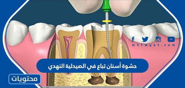 حشوات الاسنان المباعه في صيدلية النهدي
